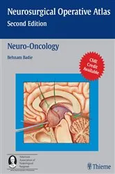 Book cover of Neuro-Oncology (2nd ed.) by Behnam Badie