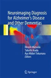 Book cover of Neuroimaging Diagnosis for Alzheimer's Disease and Other Dementias by Hiroshi Matsuda