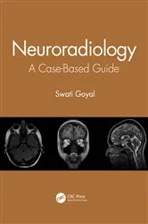 Book cover of Neuroradiology by Swati Goyal