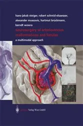 Book cover of Neurosurgery of Arteriovenous Malformations and Fistulas by Robert Schmid-Elsaesser