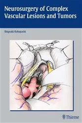 Book cover of Neurosurgery of Complex Vascular Lesions and Tumors by S. Kobayashi