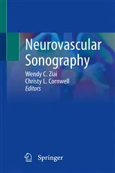 Book cover of Neurovascular Sonography by Wendy C. Ziai
