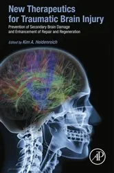 Book cover of New Therapeutics for Traumatic Brain Injury by Kim Heidenreich