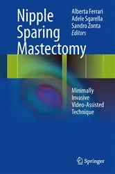 Book cover of Nipple Sparing Mastectomy by Alberta Ferrari