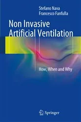 Book cover of Non Invasive Artificial Ventilation by Stefano Nava