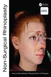 Book cover of Non-Surgical Rhinoplasty by Dario Bertossi