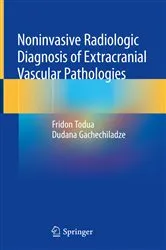 Book cover of Noninvasive Radiologic Diagnosis of Extracranial Vascular Pathologies by Fridon Todua