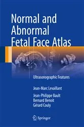 Book cover of Normal and Abnormal Fetal Face Atlas by Jean-Marc Levaillant