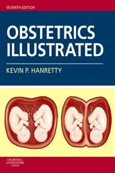 Book cover of Obstetrics Illustrated E-Book (7th ed.) by Unknown
