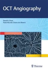 Book cover of OCT Angiography by David Chow
