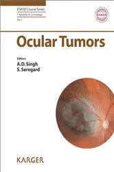 Book cover of Ocular Tumors by A.D. Singh