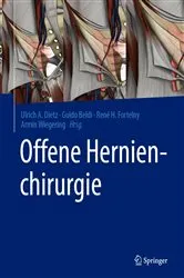 Book cover of Offene Hernienchirurgie by Ulrich A. Dietz