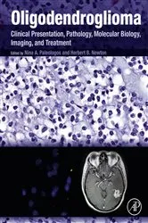 Book cover of Oligodendroglioma by Nina A. Paleologos