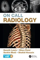 Book cover of On Call Radiology by Gareth Lewis