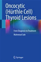 Book cover of Oncocytic (HÃ¼rthle Cell) Thyroid Lesions by Mahmoud Sakr
