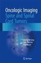 Book cover of Oncologic Imaging: Spine and Spinal Cord Tumors by Heung Sik Kang