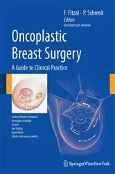 Book cover of Oncoplastic Breast Surgery by Florian Fitzal