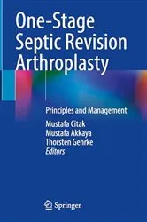 Book cover of One-Stage Septic Revision Arthroplasty by Mustafa Citak