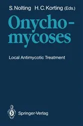 Book cover of Onychomycoses by Siegfried Nolting