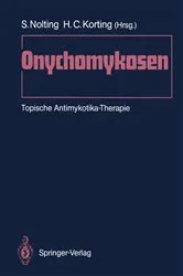 Book cover of Onychomykosen by Siegfried Nolting