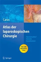 Book cover of Operationsatlas Laparoskopische Chirurgie by Unknown