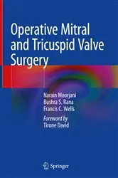 Book cover of Operative Mitral and Tricuspid Valve Surgery by Narain Moorjani
