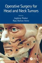 Book cover of Operative Surgery for Head and Neck Tumors by Jagdeep Thakur