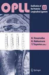 Book cover of OPLL (2nd ed.) by K. Yonenobu