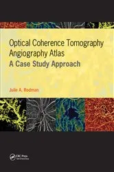 Book cover of Optical Coherence Tomography Angiography Atlas by Julie Rodman