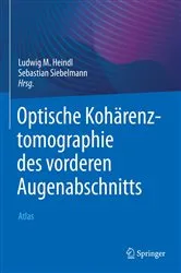Book cover of Optische Kohärenztomographie des vorderen Augenabschnitts by Ludwig M. Heindl