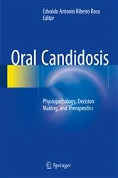 Book cover of Oral Candidosis by Edvaldo  Antonio Ribeiro  Rosa
