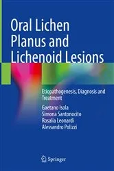 Book cover of Oral Lichen Planus and Lichenoid Lesions by Gaetano Isola