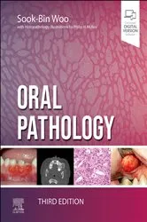 Book cover of Oral Pathology - E-Book (3rd ed.) by Woo DMD, MMSc, Sook-Bin