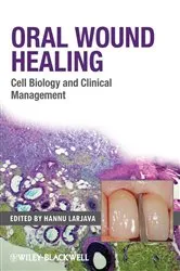 Book cover of Oral Wound Healing by Hannu Larjava