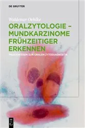 Book cover of Oralzytologie - Mundkarzinome frühzeitiger erkennen by Waldemar Oehlke