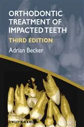 Book cover of Orthodontic Treatment of Impacted Teeth by Unknown