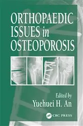 Book cover of Orthopaedic Issues in Osteoporosis by Unknown