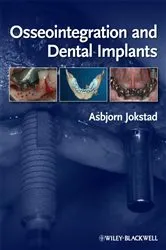 Book cover of Osseointegration and Dental Implants by Asbjorn Jokstad