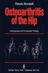 Book cover of Osteoarthritis of the Hip by R. Bombelli