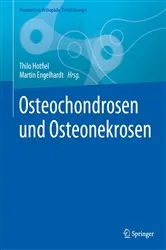 Book cover of Osteochondrosen und Osteonekrosen by Thilo Hotfiel
