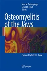 Book cover of Osteomyelitis of the Jaws by Marc Baltensperger