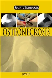 Book cover of Osteonecrosis by Babhulkar Sudhir