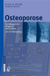 Book cover of Osteoporose by Klaus M. Peters