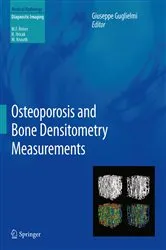 Book cover of Osteoporosis and Bone Densitometry Measurements by Giuseppe Guglielmi