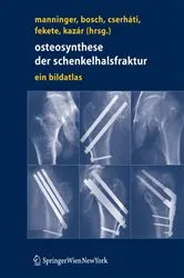 Book cover of Osteosynthese der Schenkelhalsfraktur by Jenö Manninger