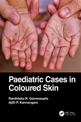 Book cover of Paediatric Cases in Coloured Skin by Ranthilaka R. Gammanpila