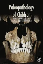 Book cover of Paleopathology of Children by Mary Lewis