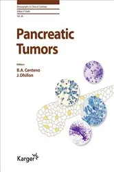 Book cover of Pancreatic Tumors by Philippe Vielh