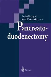 Book cover of Pancreatoduodenectomy by Fujio Hanyu