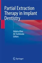 Book cover of Partial Extraction Therapy in Implant Dentistry by Udatta Kher